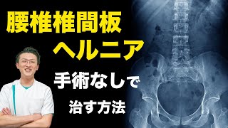 腰椎椎間板ヘルニア手術なしで治す方法