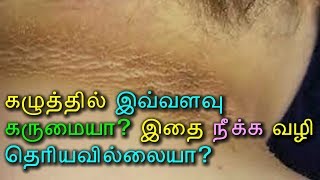 கழுத்தில் இவ்வளவு கருமையா? இதை நீக்க வழி தெரியவில்லையா? - Tamil Health Tips!