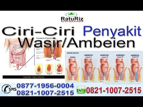 CIRI - CIRI PENYAKIT WASIR / AMBEIEN | CARA MENGOBATI PENYAKIT WASIR ...