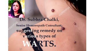 WARTS, আঁচিল থেকে মুক্তি মাত্র সাতদিনে।