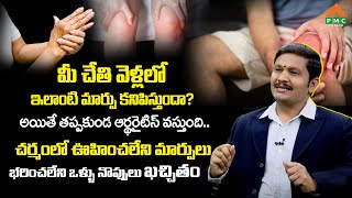 మీ చేతి వెళ్లలో ఇలాంటి మార్పు కనిపిస్తుందా? అయితే తప్పకుండ ఆర్థరైటిస్ వస్తుంది.. | PMC Health