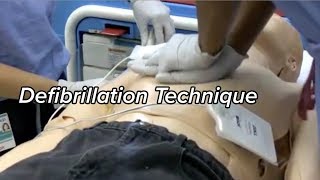 How to Defibrillate | Defibrillation Technique