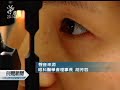 20120226 公視晚間新聞 眼科學會：手術技術成熟 安全無虞