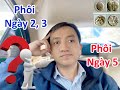 #231. Nên Chuyển Phôi Ngày 2,3 hay Phôi Ngày 5 ? Hỏi Bác Sỹ Sinh Sản