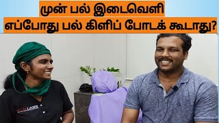 முன் பல் இடைவெளி சிகிச்சை செலவு , cost of front teeth gap filling in Tamil