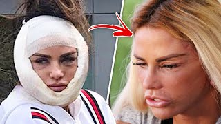 Top 10 Celebrities Who Went WAY Too Far With Botox