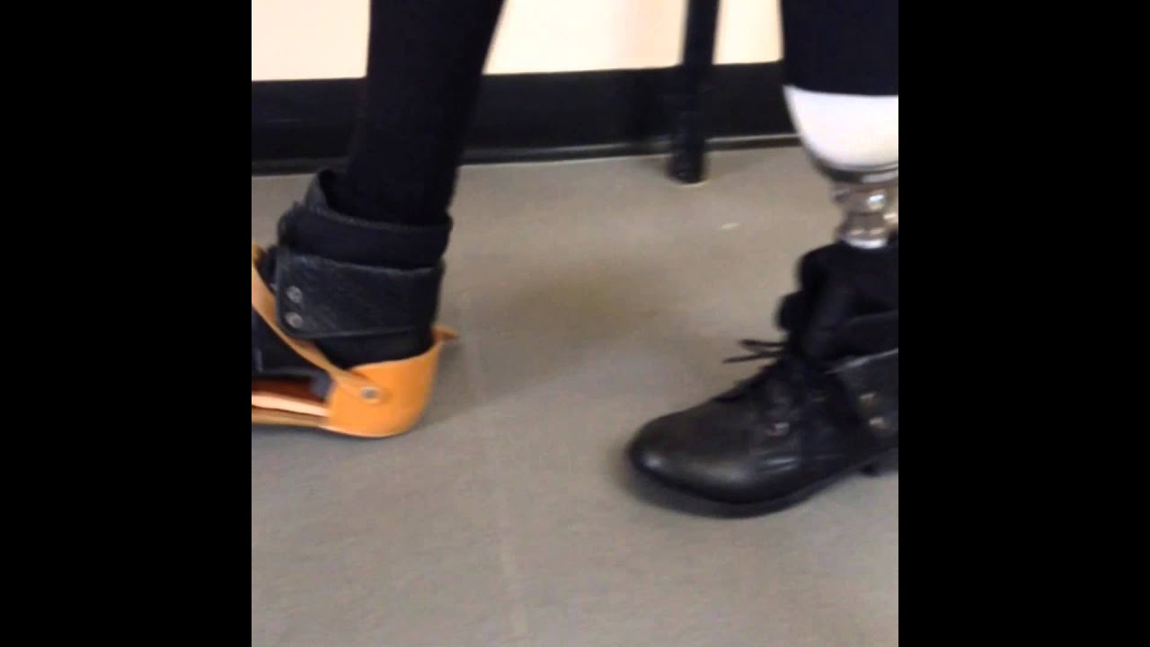 First Walk On A Prosthetic - YouTube