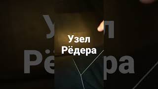 Узел Рёдера | Жаугашев #лапароскопия #жаугашев