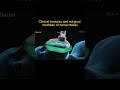 clinical features and surgical method of hemorrhoids #short # animation