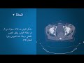 cancer staging arabic chapter 4 أمثلة على تصنيف السرطان