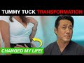 How Can a Tummy Tuck with Dr. Shim Ching Transform Your Body?