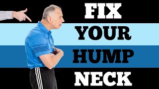 Single Best Fix (6 Min) for Neck Hump (Buffalo Hump)