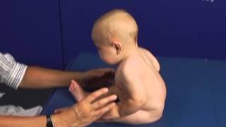 6 Month Old Babies in Pull to Sit Movement,  Typical and Atypical Development Comparison