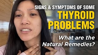 Dr. Farrah on the Signs \u0026 Symptoms of different Thyroid Problems and the Natural Remedies for these