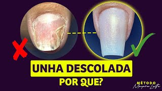 UNHA DESCOLADA POR QUE? | Mayara Leitte