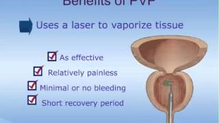 Photoselective Vaporization of the Prostate (PVP) Laser Therapy for BPH