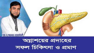 পেনক্রিয়াসের প্রদাহ (Pancreatitis) বা অগ্নাশয়ের প্রদাহের সফল চিকিৎসা ও প্রমাণ।