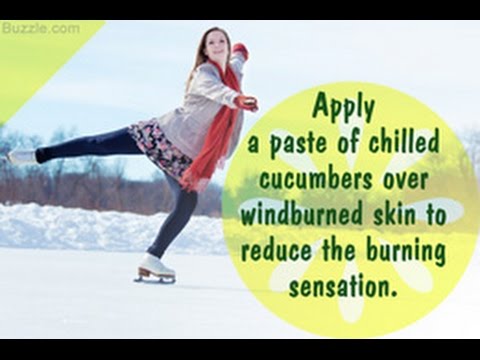 21 Effective Home Remedies for Windburn 21 Effective Home Remedies for Windburn