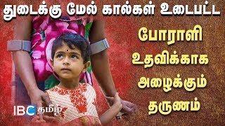 துடைக்கு மேல் கால்கள் உடைபட்ட போராளி உதவிக்காக அழைக்கும் தருணம் | En Iname En Saname EPI 26