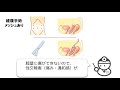 子宮脱・膀胱瘤の手術　どうやって使い分けるの？　われわれの基準を説明いたします。