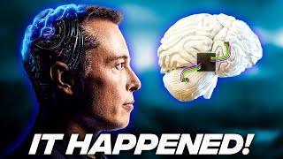 IT HAPPENED! Elon Musk Is FINALLY Testing Neuralink on Humans -2022