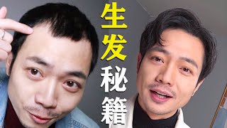 禿頂到無可救藥？親測有效的生髮秘籍大公開！