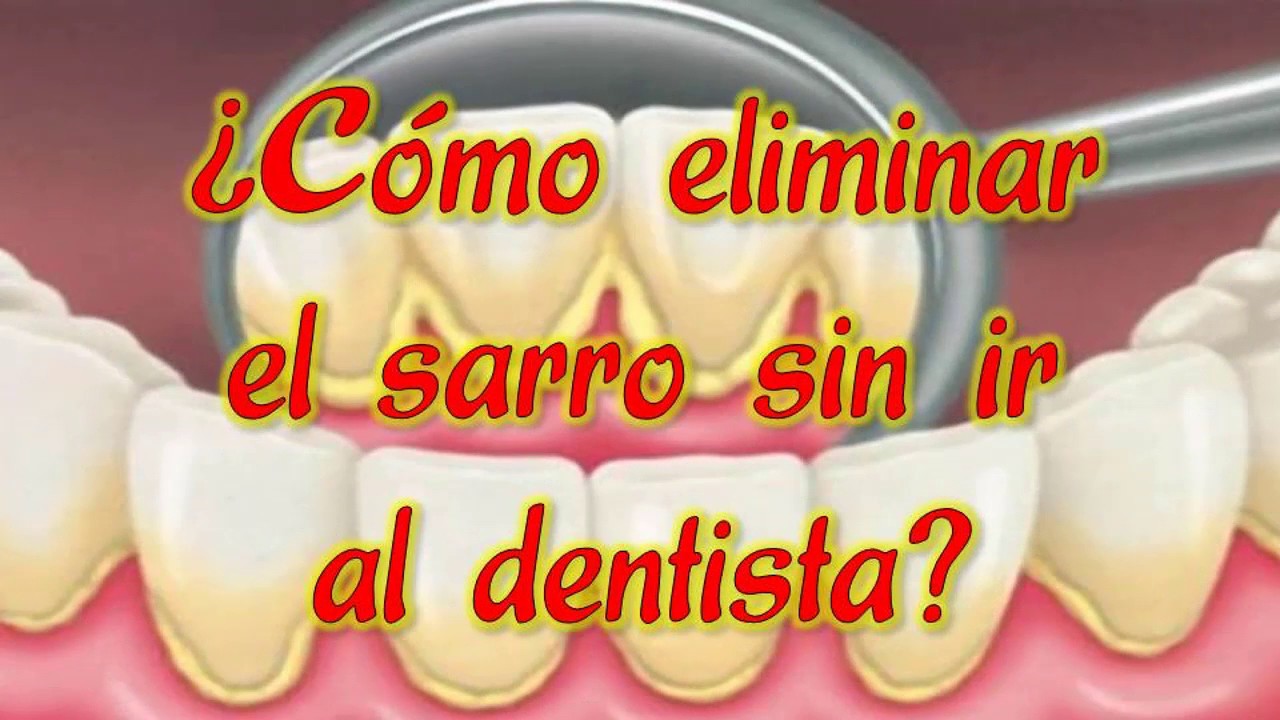 Como Eliminar El Sarro De Los Dientes Sin Ir Al Dentista - YouTube