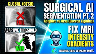 Mastering Medical Image Segmentation with Adaptive Otsu Thresholding Part 2