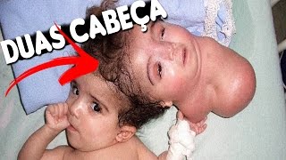 5 MUTAÇÕES QUE ACONTENCEM COM HUMANOS