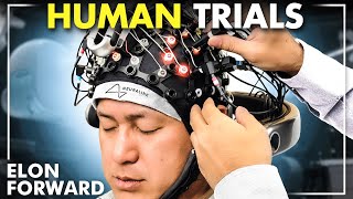 Neuralink Brain Implant Begins Human Trials
