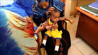 Sudan facing measles outbreak with 2,500 cases nationwide