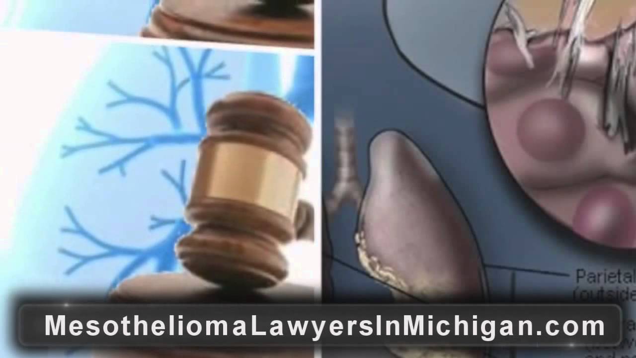 Michigan Mesothelioma Lawyer | Michigan Asbestos Mesothelioma Attorney ...