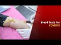 COVID19: Types Of Blood Tests You Can Go For | News Mo