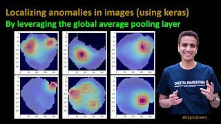 262 - Localizing anomalies in images