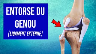 Entorse du genou (Ligament Externe) : Les Traitements