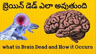 What is brain dead and how it occurs//what is brain dead explained in Telugu