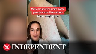 Expert reveals reason why mosquitos like some people a lot more than others