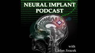 Dr Steve Potter on his work with cultured neurons and keeping the work open source