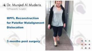 MPFL Reconstruction for Patellar Malalignment Dislocation - 3 months post surgery