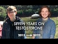 7 Years on Testosterone | FTM Transition