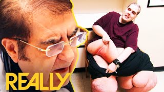 Steven Assanti Tells Dr. Now He Stinks Because Of A Rash | My 600 Lb Life: Where Are They Now?