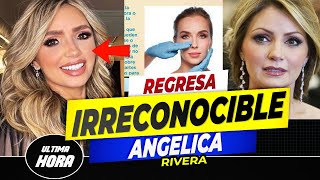 😭 𝗗𝗘𝗦𝗙𝗜𝗚𝗨-𝗥𝗔-𝗗4... Angelica Rivera Parece Otra Persona / 𝗫 𝗖𝗨𝗟𝗣𝗔 𝗗𝗘 𝗟𝗔𝗦 𝗖𝗜𝗥𝗨𝗚1𝗔𝗦 𝗣𝗟𝗔𝗦𝗧𝗜𝗖𝗔𝗦 🔥