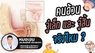 คนอ้วน จู๋เล็กและสั้นจริงรึเปล่า ?| หมอจู๋ คู่หูชายไทย