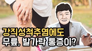 [이뮨닥터스] 강직성척추염에도 무릎, 발가락 통증이?