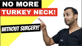 The NON-SURGICAL turkey neck lift!
