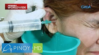 Ear irrigation, paano nga ba ginagawa? | Pinoy MD