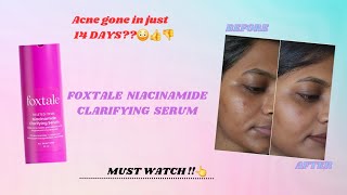 New* Foxtale Niacinamide Clarifying Serum- review after 14 days‼️😳Watch| that_glow_addict|skincare✨️