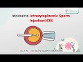 เทคโนโลยีการเจริญพันธุ์ด้วย ivf กับ icsi คืออะไร และแตกต่างกันอย่างไร │bpk9 international hospital