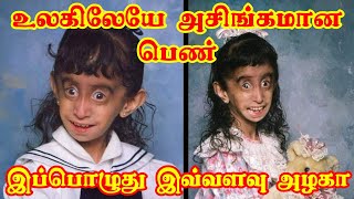 The World's Ugliest Woman இவளை ஏன் உயிருடன் வைத்திருக்கிறார்கள் உலக அசிங்கமான பெண் lizzitachickita