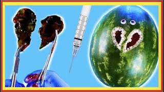 Emergency #FruitSurgery! Pineapple has broken heart - #DiscountDentist Ep 162 #Shorts